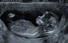 IMG_20180125_1_1.jpg