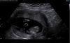 upload_2018-1-31_19-14-46.png