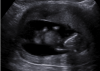 upload_2018-1-31_20-25-46.png