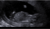 upload_2018-1-31_20-26-3.png