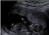 upload_2018-1-31_20-29-58.png