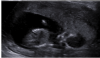 upload_2018-1-31_20-30-14.png