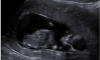 upload_2018-1-31_20-30-30.png