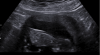 upload_2018-1-31_20-30-44.png