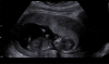 upload_2018-1-31_21-49-13.png