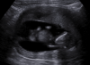 upload_2018-1-31_21-49-29.png