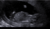 upload_2018-1-31_21-49-54.png