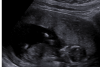 upload_2018-1-31_21-50-17.png