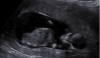upload_2018-1-31_21-50-39.png