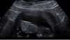upload_2018-1-31_21-50-57.png