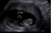 upload_2018-1-31_22-47-50.png