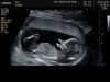 J172390_1191889_Echo.Jpg