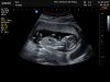 J172390_1191887_Echo.Jpg