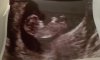 20180202_083646.jpg
