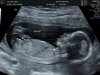 IMG_20180205_1_3.jpg