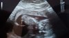 20180207_082146.jpg