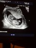 IMG-20180208-WA0025.jpg
