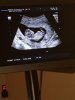 IMG-20180208-WA0046.jpg