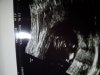 20180209_170433.jpg