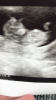 24D8E9DE-74F4-47DD-9406-F7A998299C23.png
