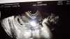IMG-20180212-WA0007.jpeg