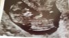IMG-20180214-WA0003.jpeg