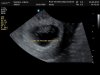 J180051_1229300_Echo.Jpg