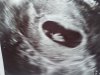 20180220_143637.jpg