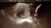 IMG-20180220-WA0009.jpeg