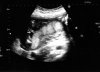 baby.jpg
