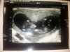 Echo 12112012.jpg