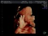 echo 4d 006.jpg