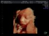 echo 4d 021.jpg