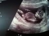 echo 12.2 wkn 1.jpg