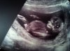 echo 12.2 wkn 2.jpg