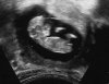 11w3d-nub-rotated-small.jpg
