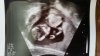 IMG-20180222-WA0005.jpeg