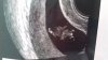 20180301_144810.jpg