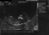 UltrasoundFeb2018_webedit.jpg