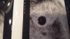 IMG-20180302-WA0000.jpeg