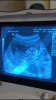 CDA278B9-72BC-47A5-867D-82B5DC9E9FAB.png