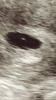 C79B6F07-A0FF-45ED-895C-362ED9D8AE4C.png