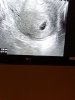 IMG-20180312-WA0005.jpg