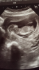 0ABB76C9-CF39-4B4A-95AE-26DDAB434910.png