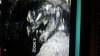 IMG-20180311-WA0040.jpeg