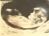 20180321_160725.png