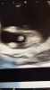 703F03CC-CB29-4081-A498-C2B1BF32281D.png