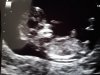20180327_150329.jpg