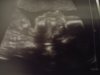 20180327_201036.jpg