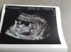 IMG-20180329-WA0003.jpeg